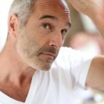 Is it Possible to Prevent Male Pattern Baldness?