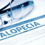Learn about the medical condition Alopecia.