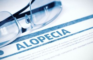 Learn about the medical condition Alopecia.