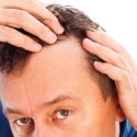 Surprising Reasons Why You May Experience Hair Loss