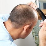 National Hair Loss Awareness Month