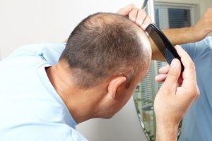 National Hair Loss Awareness Month