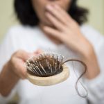 Female Hair Loss