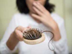 Female Hair Loss