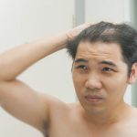 man looking in the mirror with thinning hair contemplating hair replacement