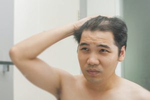 man looking in the mirror with thinning hair contemplating hair replacement