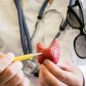 Can Poor Thyroid Function Cause Hair Loss?