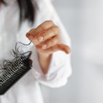 Female Hair Loss