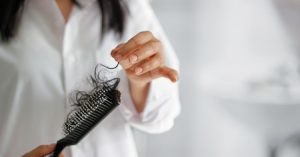 Female Hair Loss