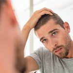 Male Hair Loss