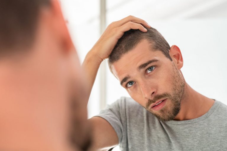 What Are The 7 Stages of Hair Loss in Men? NM Hair Replacement Studio