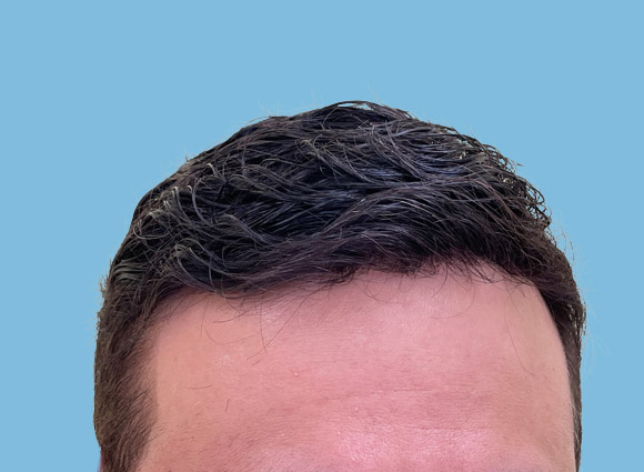 After image