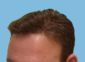 After image