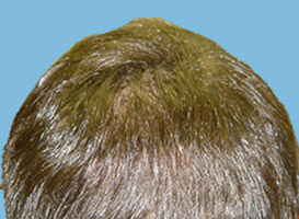 After image