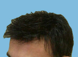 After image