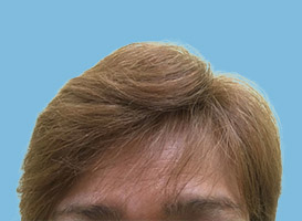 After image