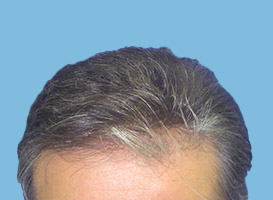 After image
