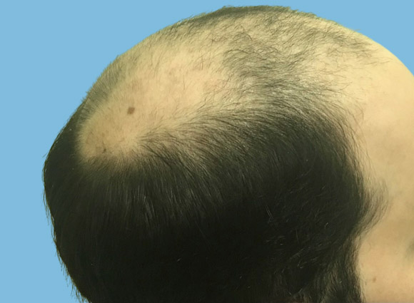 Before image