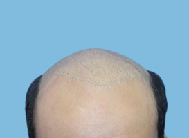 Before image