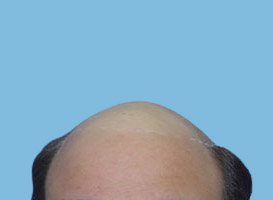 Before image