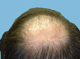 Before image