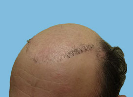Before image
