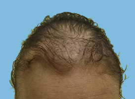 Before image